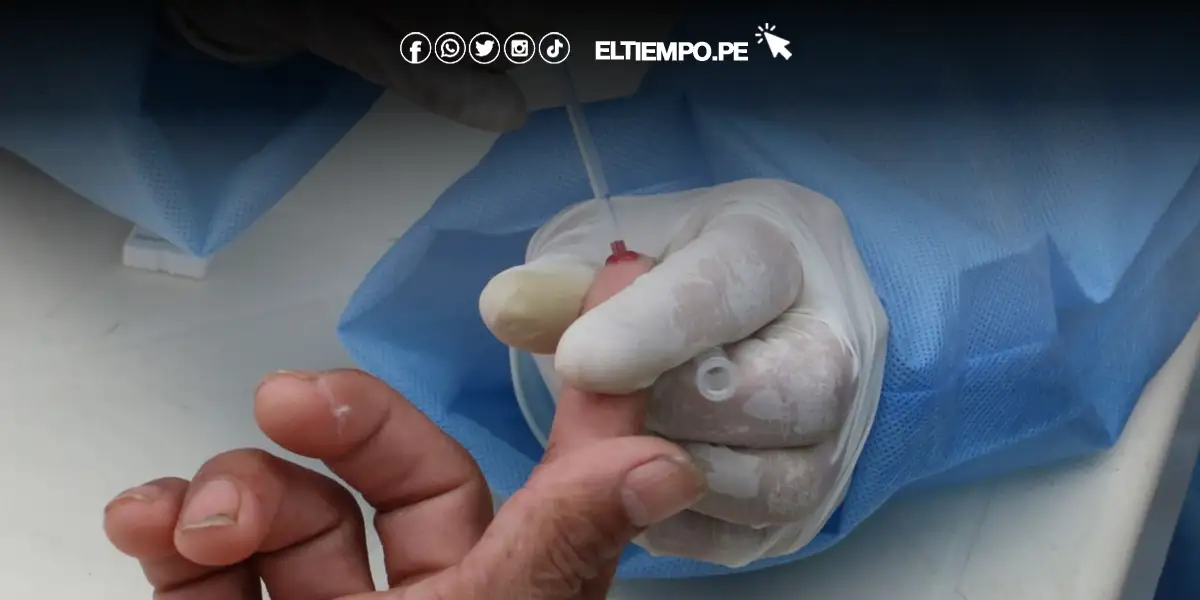 Piura: Investigan dos posibles casos de viruela del mono tras el primer confirmado