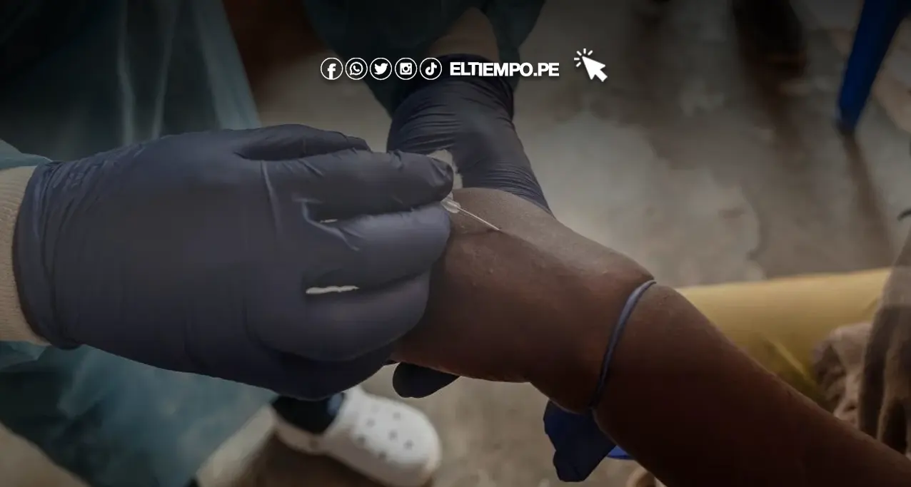 Nueva variante mpox Asia