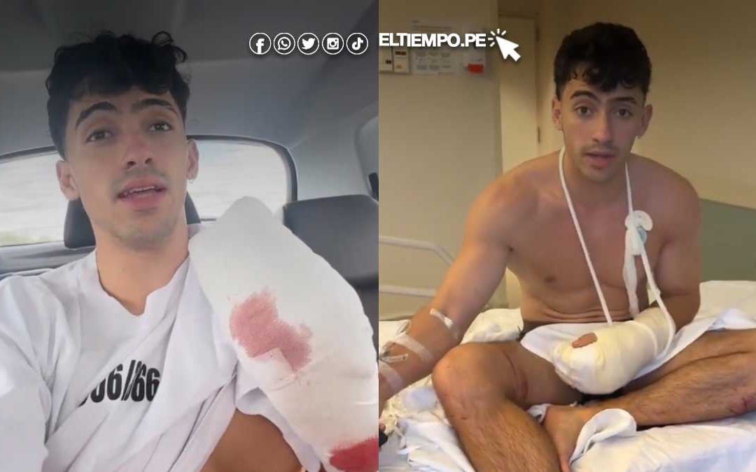 Influencer argentino, Gero Arias cae de acantilado y pierde dos dedos