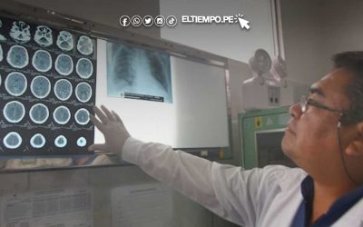 El accidente cerebrovascular o ictus isquémico es la segunda causa de muerte en el Perú