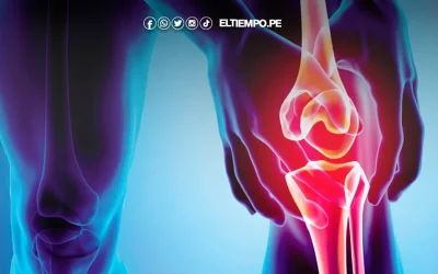 ¿Qué es la osteogénesis imperfecta? Síntomas, diagnóstico y atención gratuita en Perú