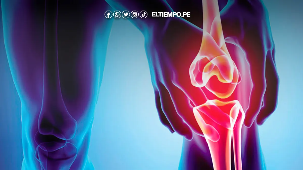 Osteogénesis imperfecta Osteogénesis imperfecta