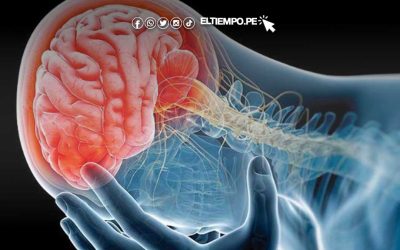 Muertes por ACV en Perú se triplicarán en los próximos 10 años, según estudios