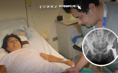 Piura: realizan primera artroplastía total de cadera en el hospital Nuestra Señora de las Mercedes de Paita