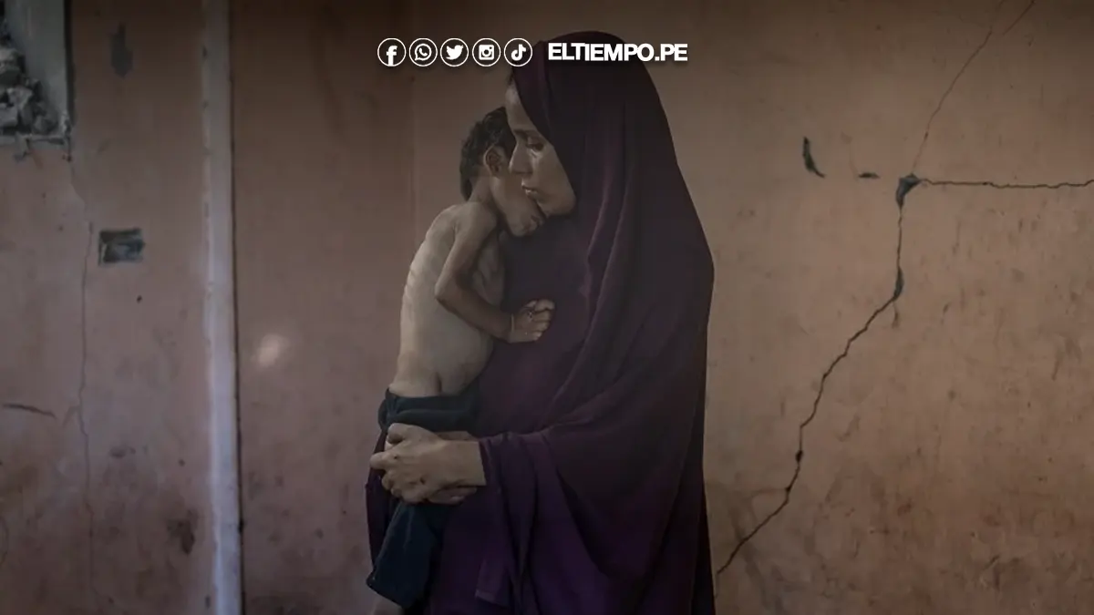 mueren niños por desnutrición en Gaza