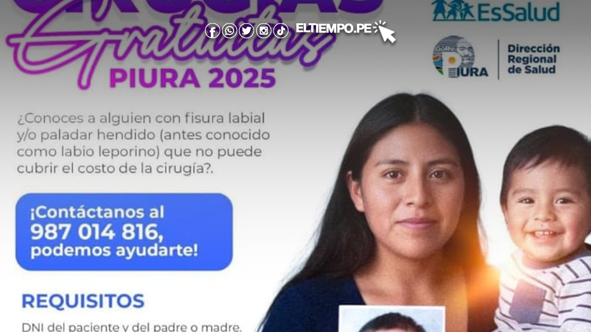 Cirugías gratuitas para fisuras labiales o paladar hendido en Piura